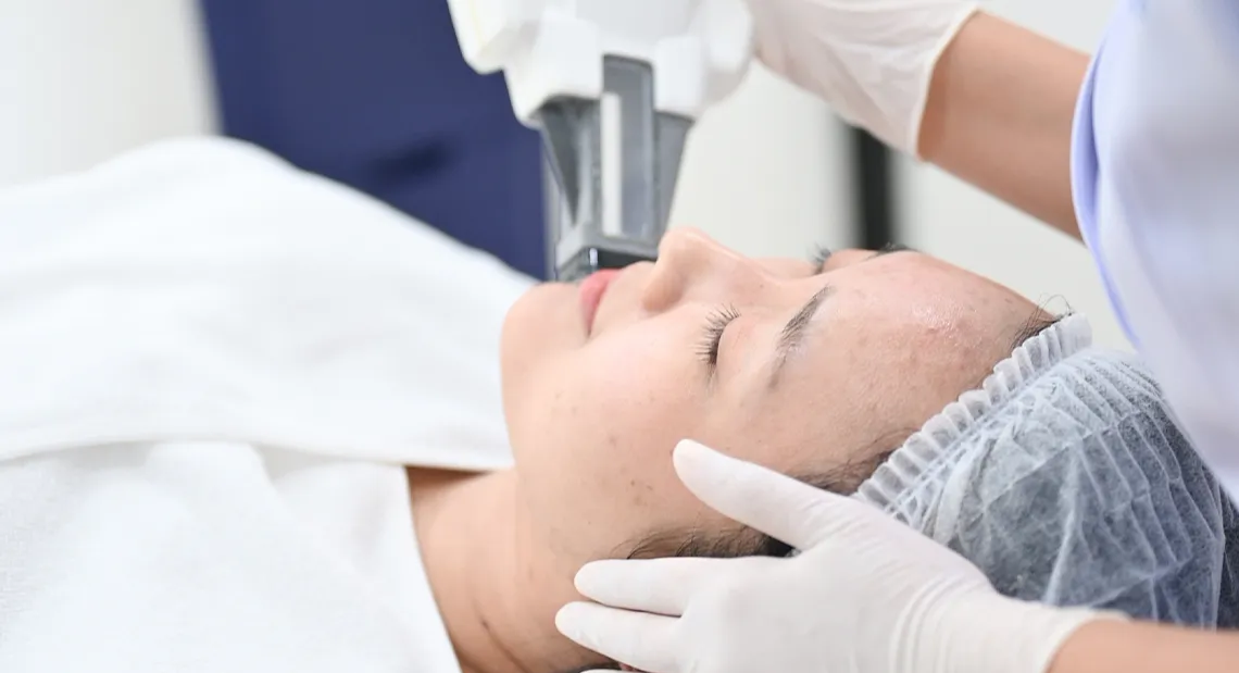 Accure laser ile akne tedavisi uygulaması